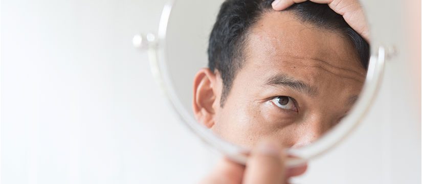 Căderea părului – cauze și soluții