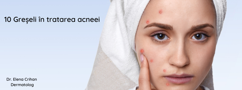 10 Greșeli în tratarea acneei